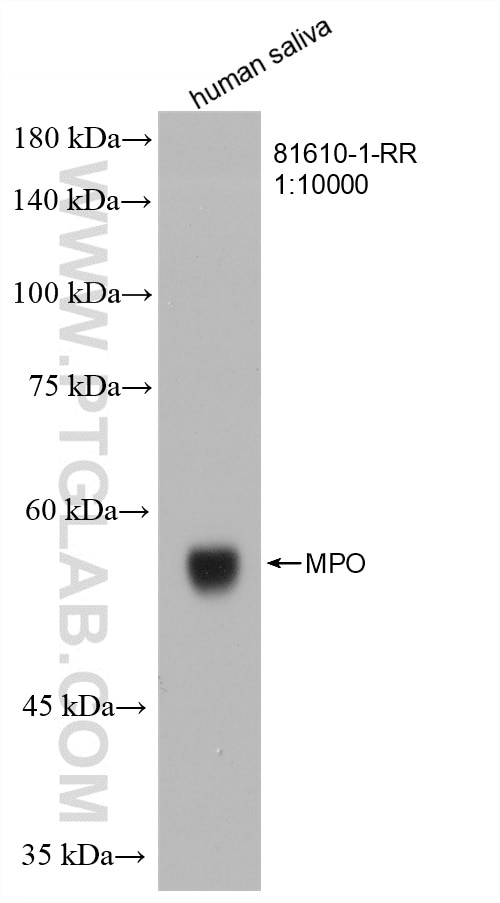 WB analysis of human saliva using 81610-1-RR