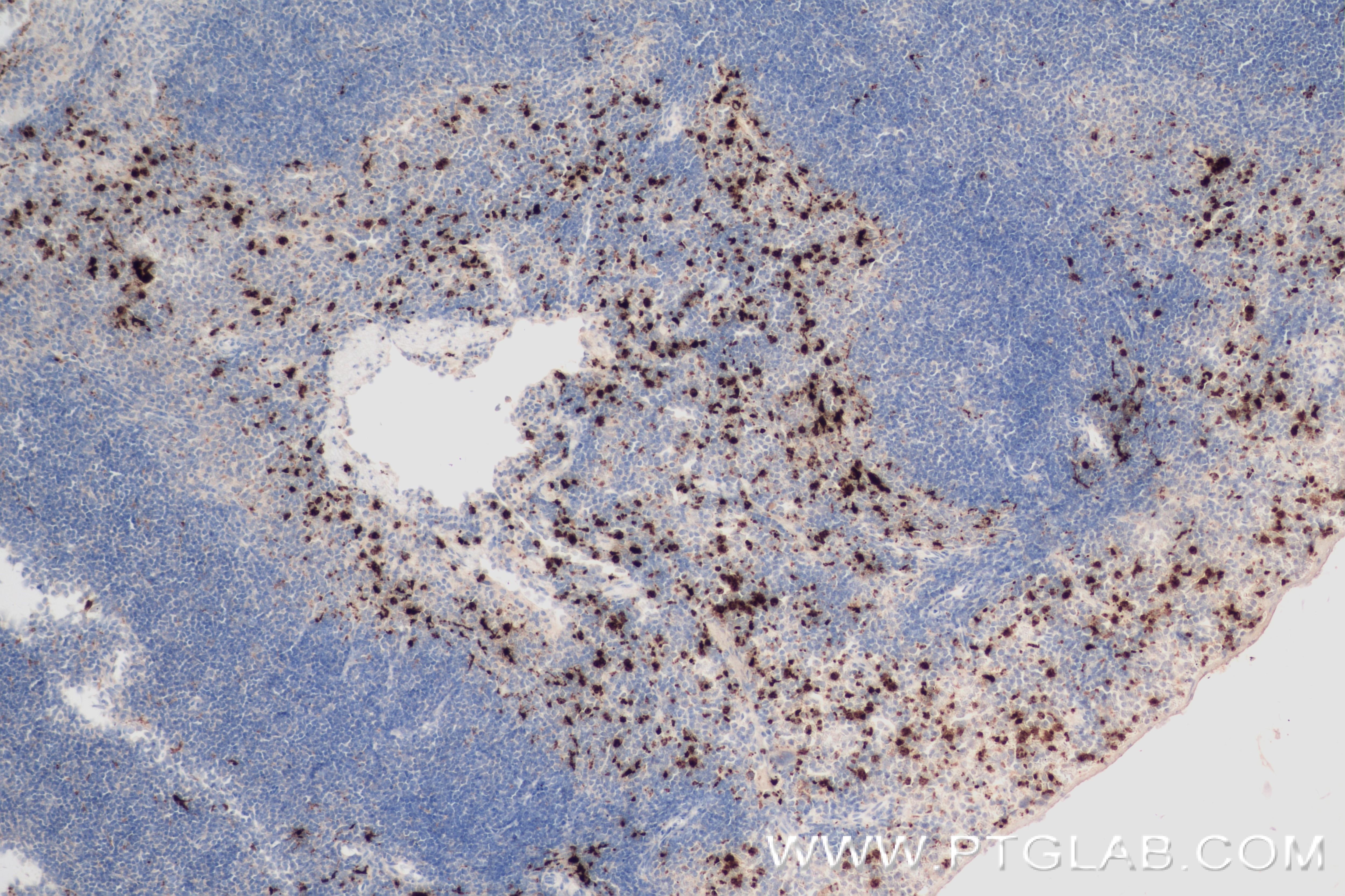 Immunohistochemistry (IHC) staining of mouse spleen tissue using Mpo Recombinant antibody (84436-5-RR)