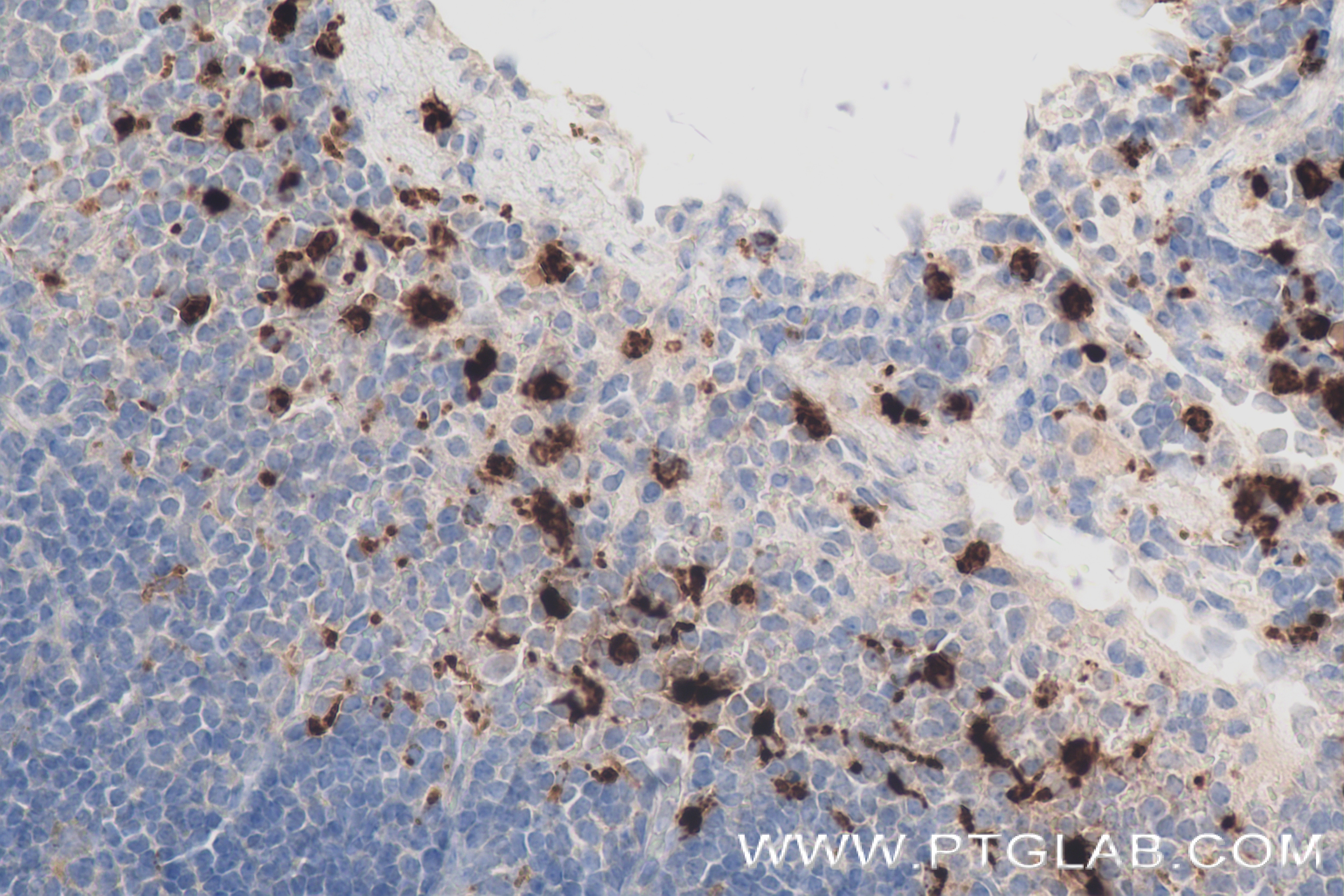 Immunohistochemistry (IHC) staining of mouse spleen tissue using Mpo Recombinant antibody (84436-5-RR)