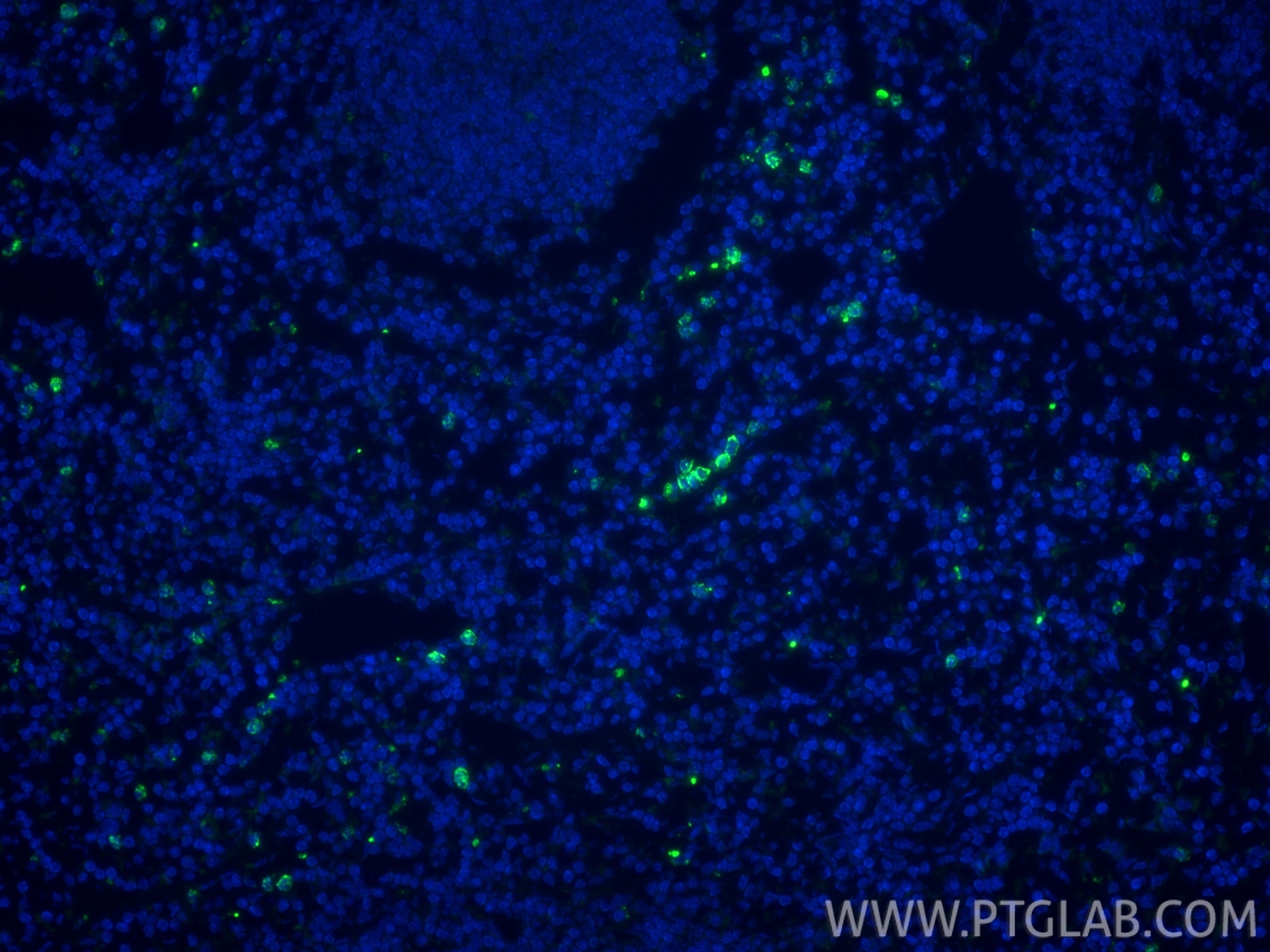 Immunofluorescence (IF) / fluorescent staining of mouse spleen tissue using Biotin-conjugated MPO Polyclonal antibody (Biotin-22225)