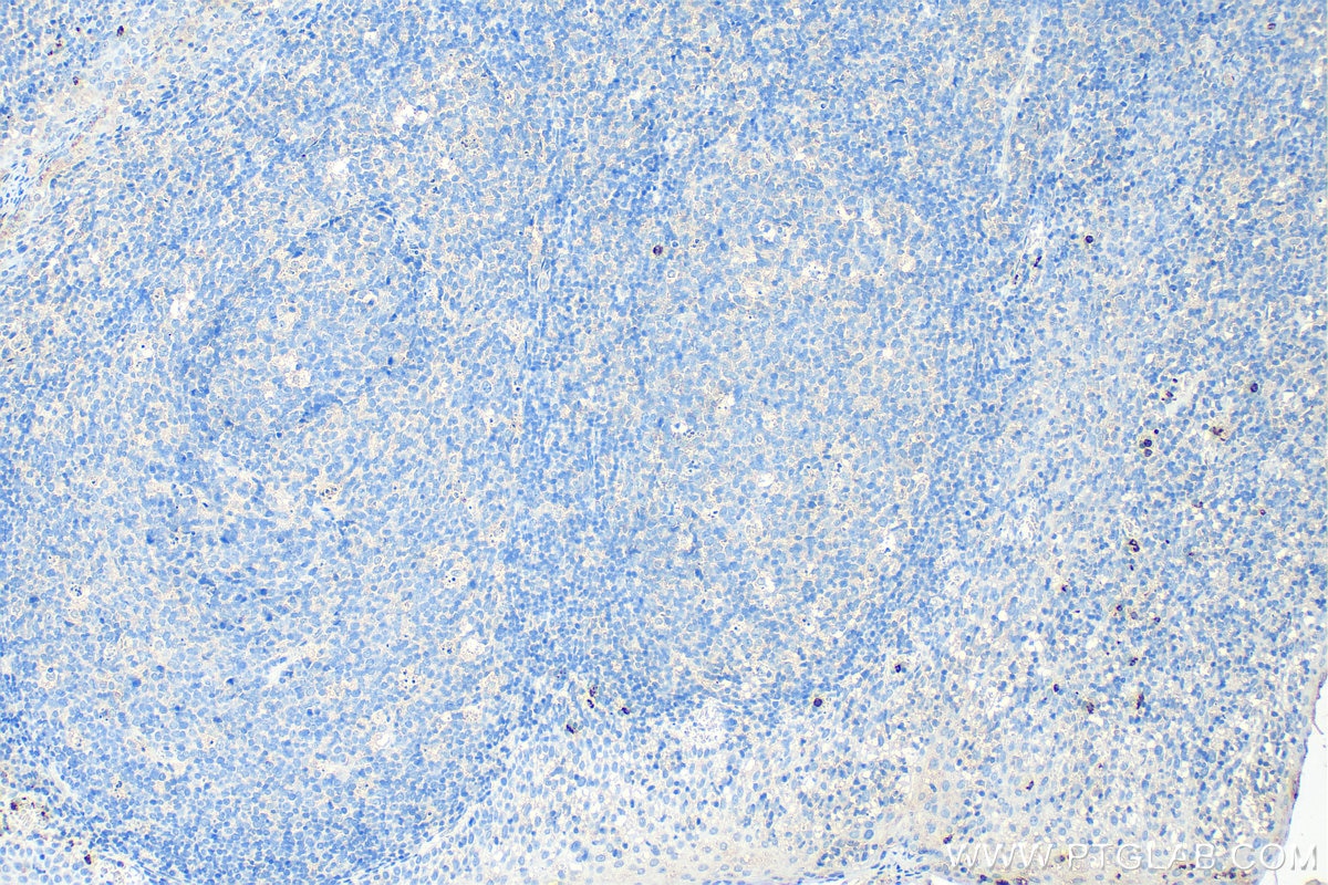 Immunohistochemistry (IHC) staining of human tonsillitis tissue using Biotin-conjugated MPO Monoclonal antibody (Biotin-66177)