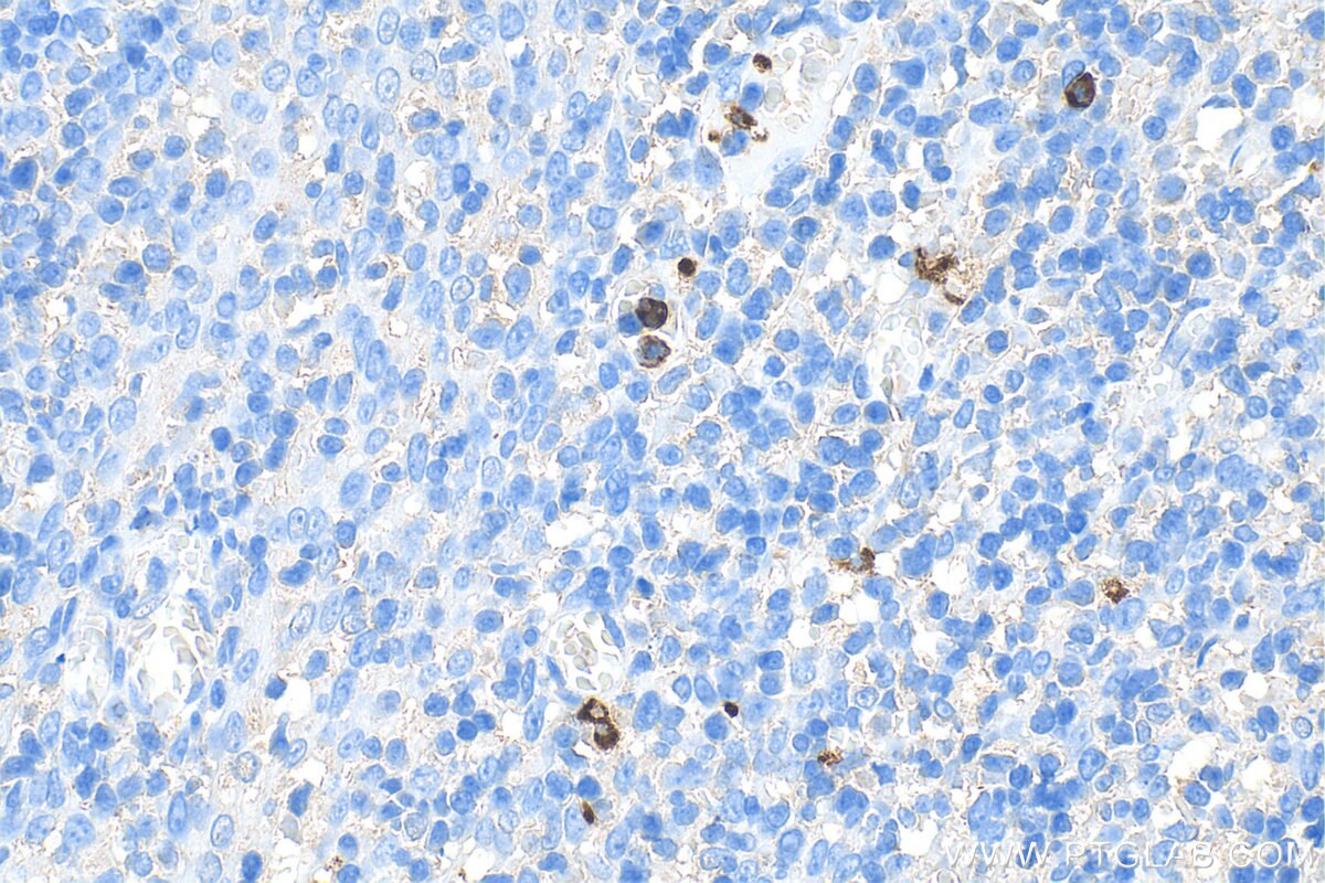 Immunohistochemistry (IHC) staining of human tonsillitis tissue using Biotin-conjugated MPO Monoclonal antibody (Biotin-66177)
