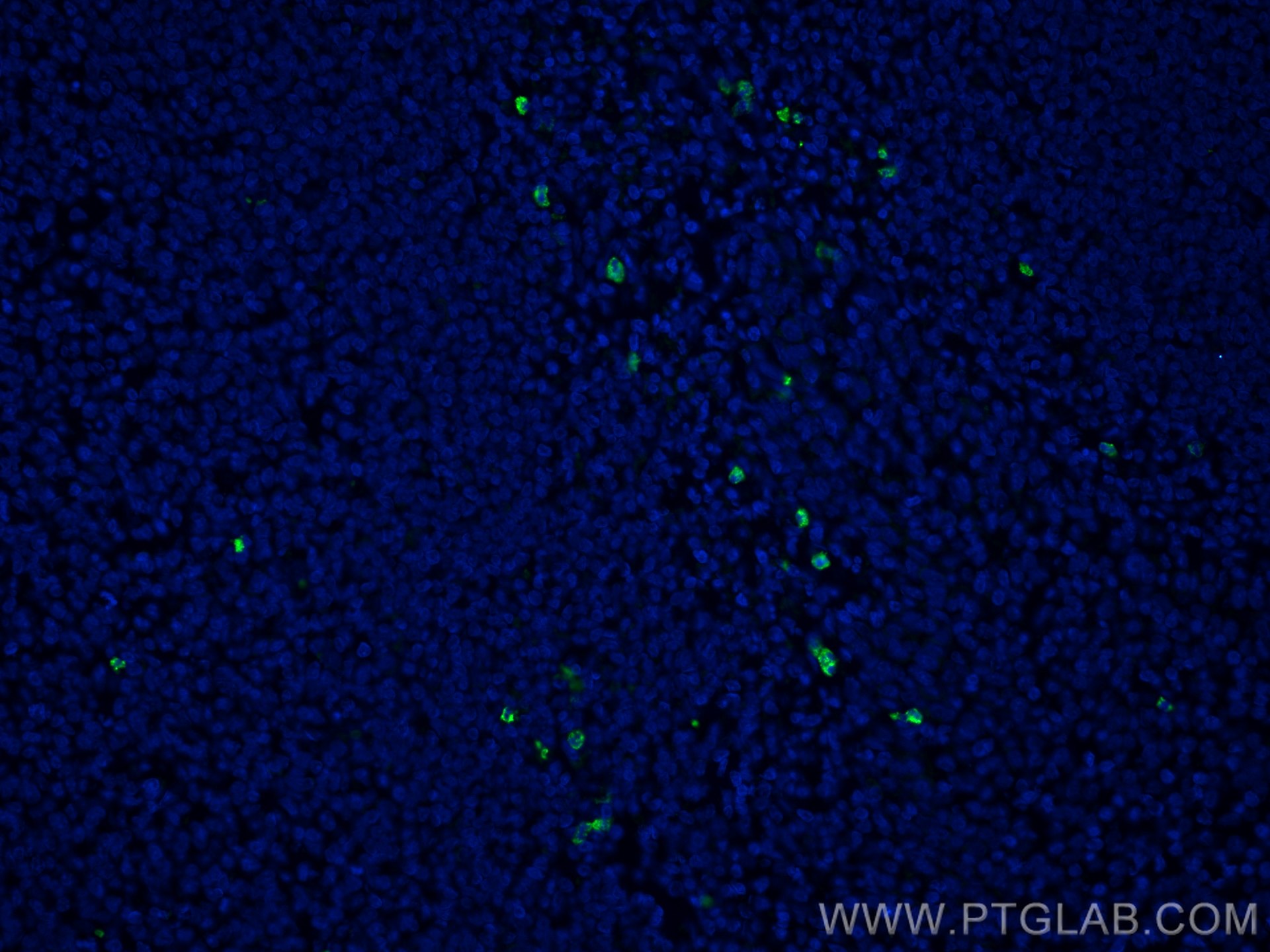 Immunofluorescence (IF) / fluorescent staining of human tonsillitis tissue using CoraLite® Plus 488-conjugated MPO Monoclonal antib (CL488-66177)