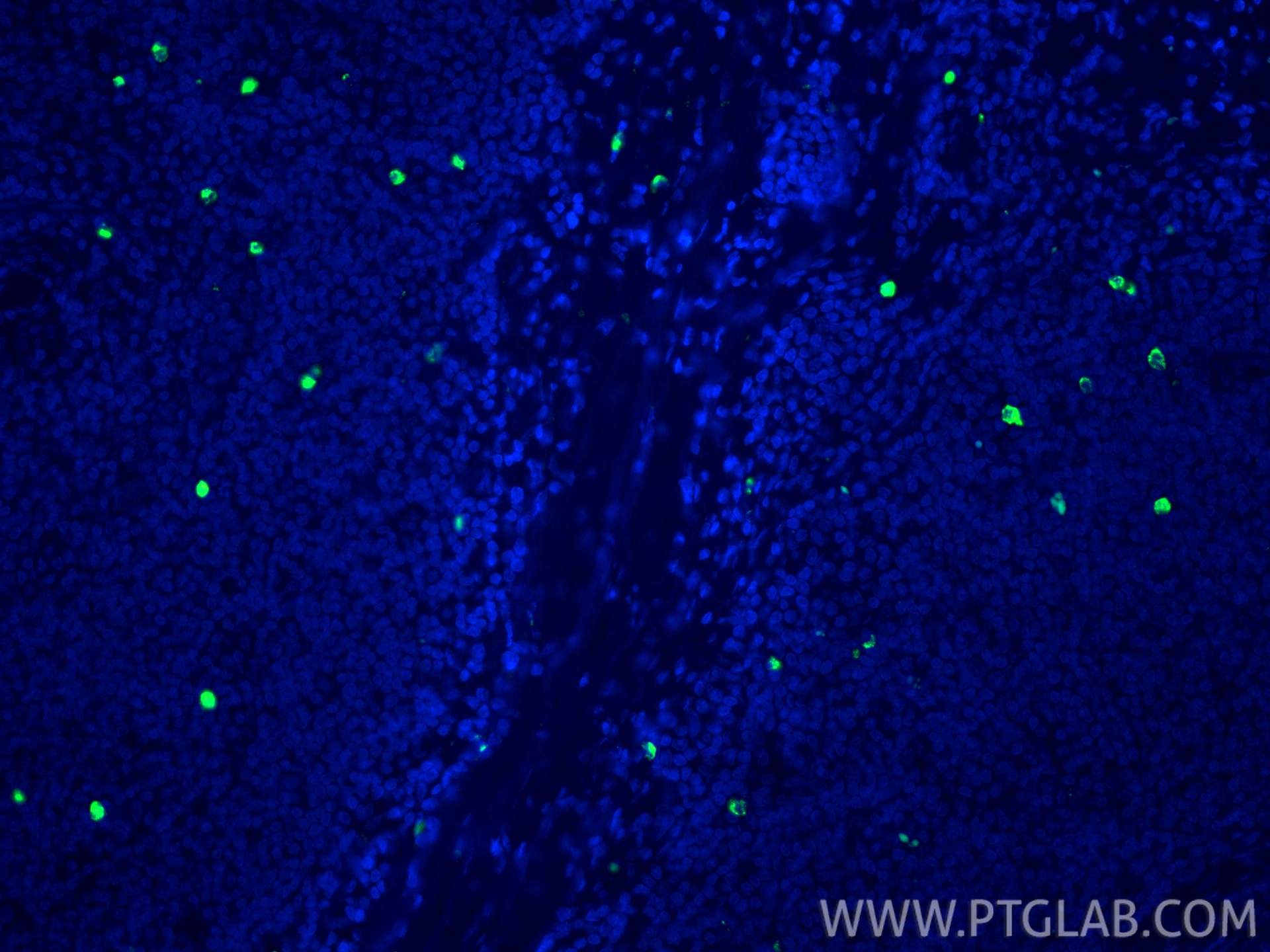Immunofluorescent analysis of (4% PFA) fixed paraffin-embedded human tonsillitis tissue using CoraLite® Plus 488 MPO antibody (CL488-81610, Clone: 3J17 ) at dilution of 1:200. Heat mediated antigen retrieval with Tris-EDTA buffer (pH 9.0). Immunofluorescence (IF) / fluorescent staining of human tonsillitis tissue using CoraLite® Plus 488-conjugated MPO Recombinant mono (CL488-81610)