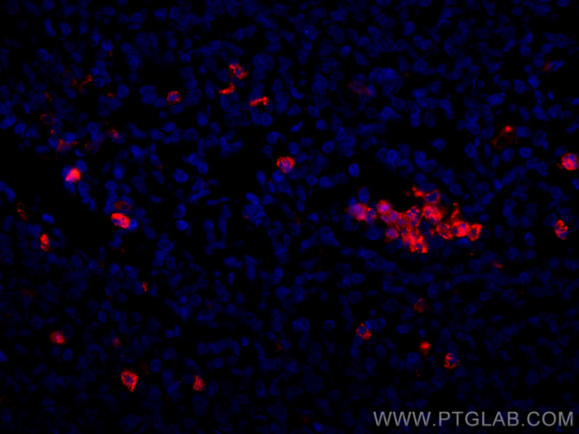 Immunofluorescence (IF) / fluorescent staining of human tonsillitis tissue using CoraLite®594-conjugated MPO Monoclonal antibody (CL594-66177)
