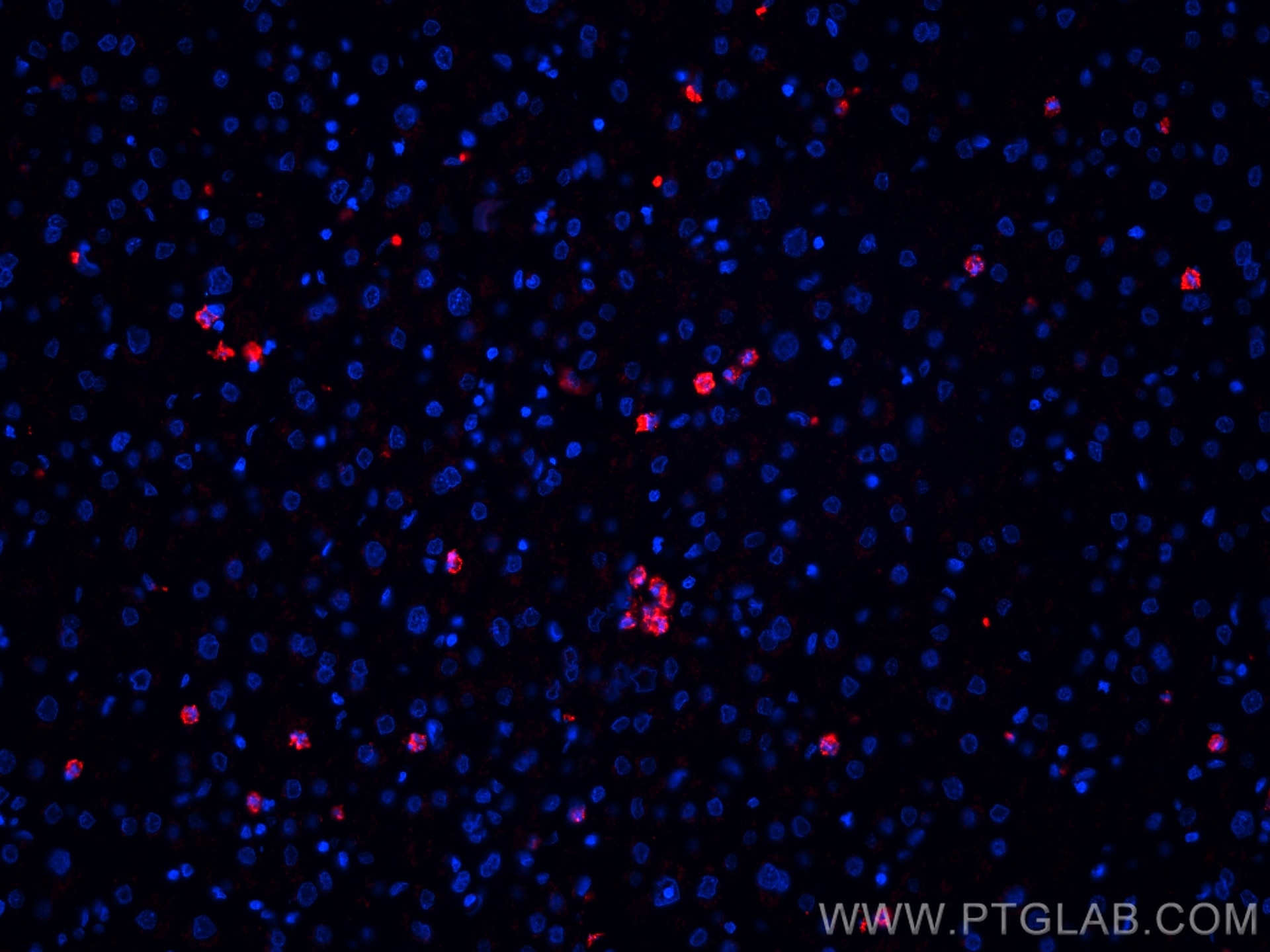 Immunofluorescence (IF) / fluorescent staining of human liver tissue using CoraLite®594-conjugated MPO Monoclonal antibody (CL594-66177)