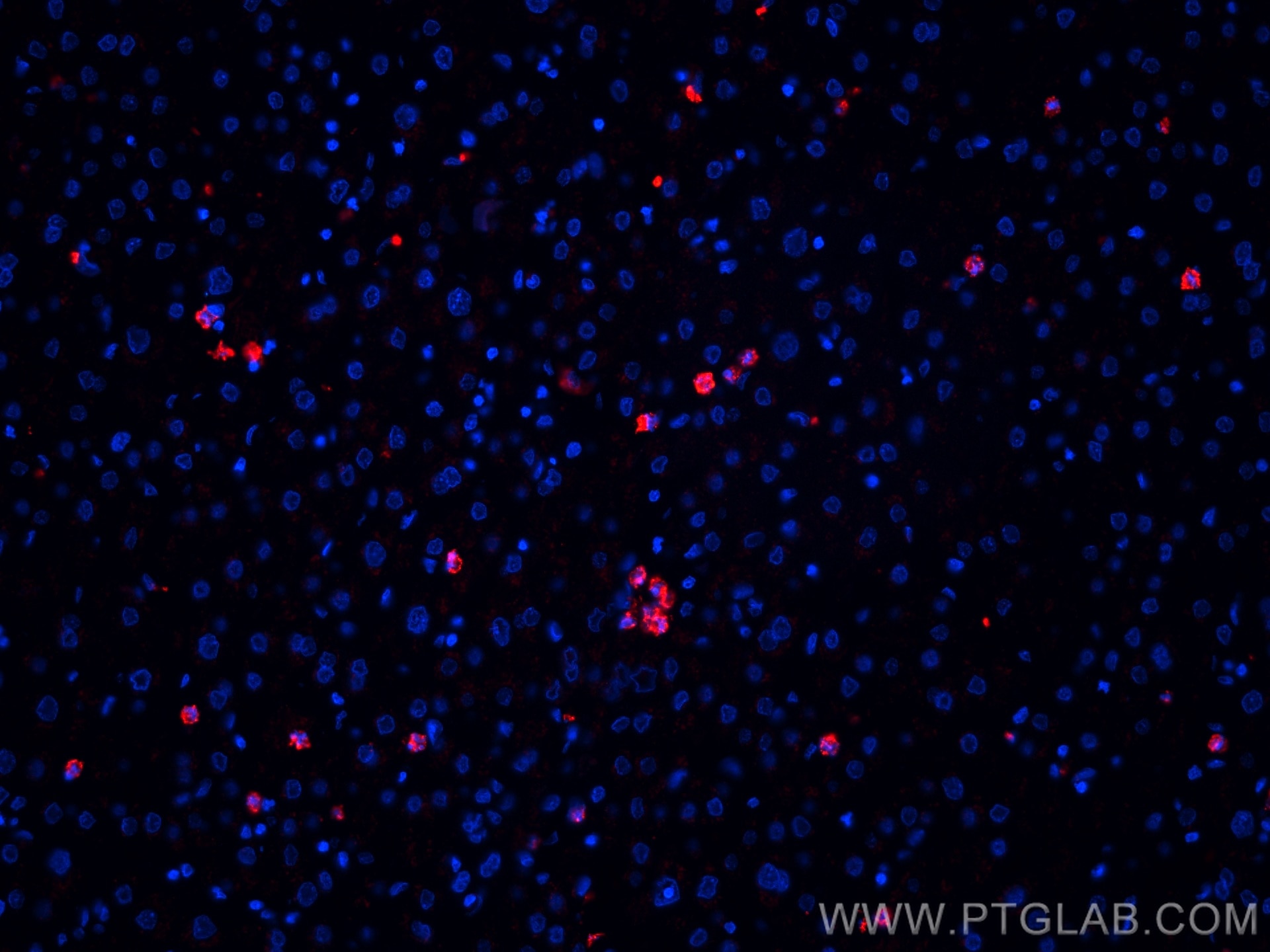 IF Staining of human liver using CL594-66177