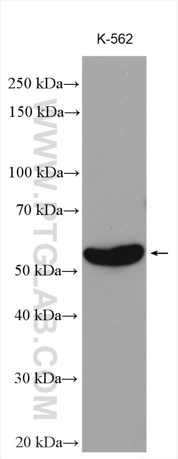 Western Blot (WB) analysis of various lysates using MPP1 Polyclonal antibody (14715-1-AP)