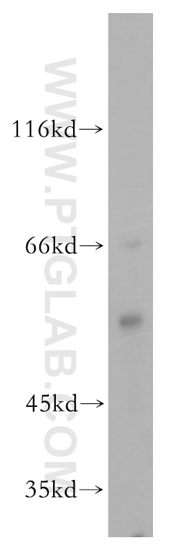 Western Blot (WB) analysis of mouse thymus tissue using MPP1 Polyclonal antibody (14715-1-AP)