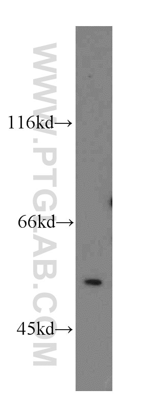 Western Blot (WB) analysis of mouse thymus tissue using MPP1 Polyclonal antibody (14715-1-AP)