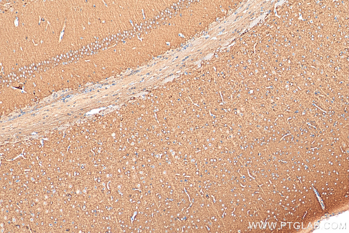 Immunohistochemistry (IHC) staining of mouse brain tissue using MPP2 Polyclonal antibody (13589-1-AP)