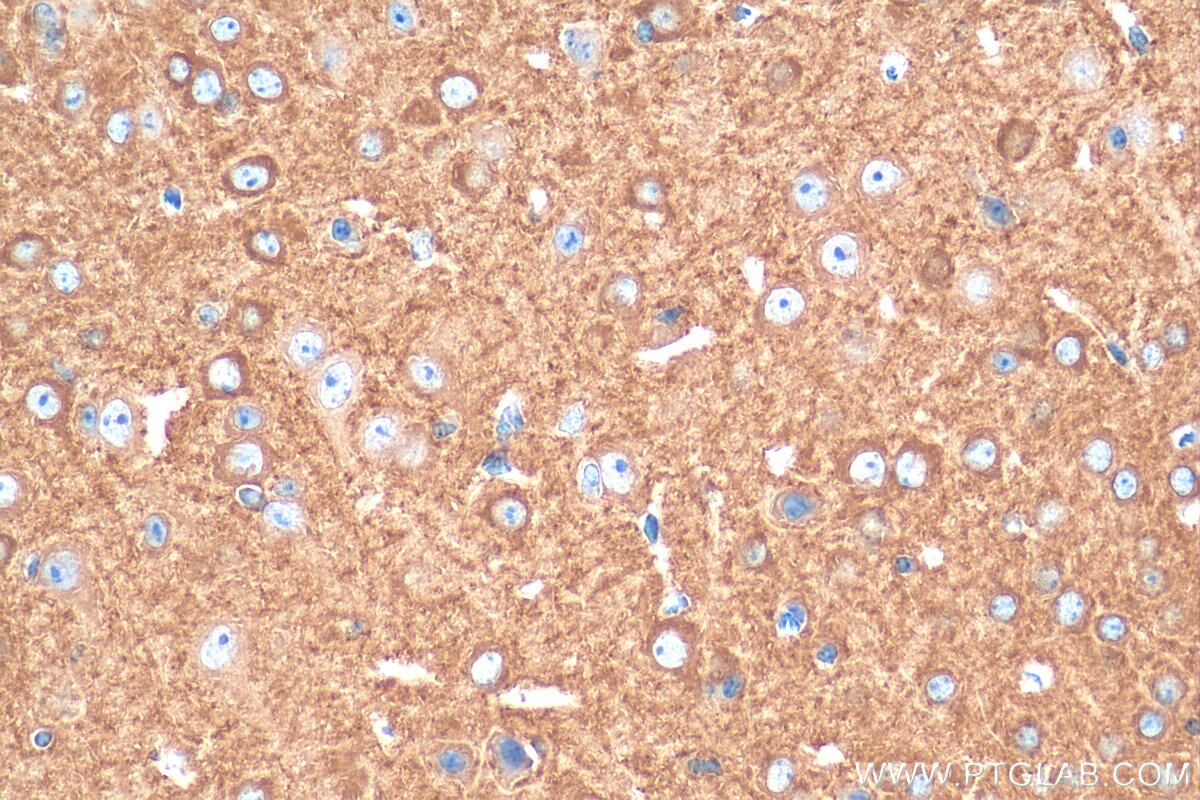 Immunohistochemistry (IHC) staining of mouse brain tissue using MPP2 Polyclonal antibody (13589-1-AP)