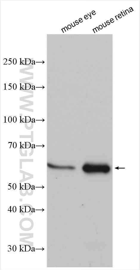 Western Blot (WB) analysis of various lysates using MPP2 Polyclonal antibody (13589-1-AP)