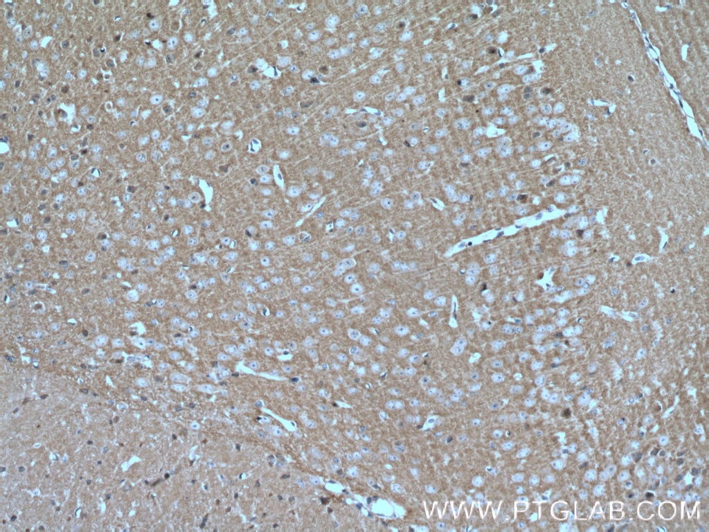 Immunohistochemistry (IHC) staining of mouse brain tissue using MPP5 Polyclonal antibody (17710-1-AP)