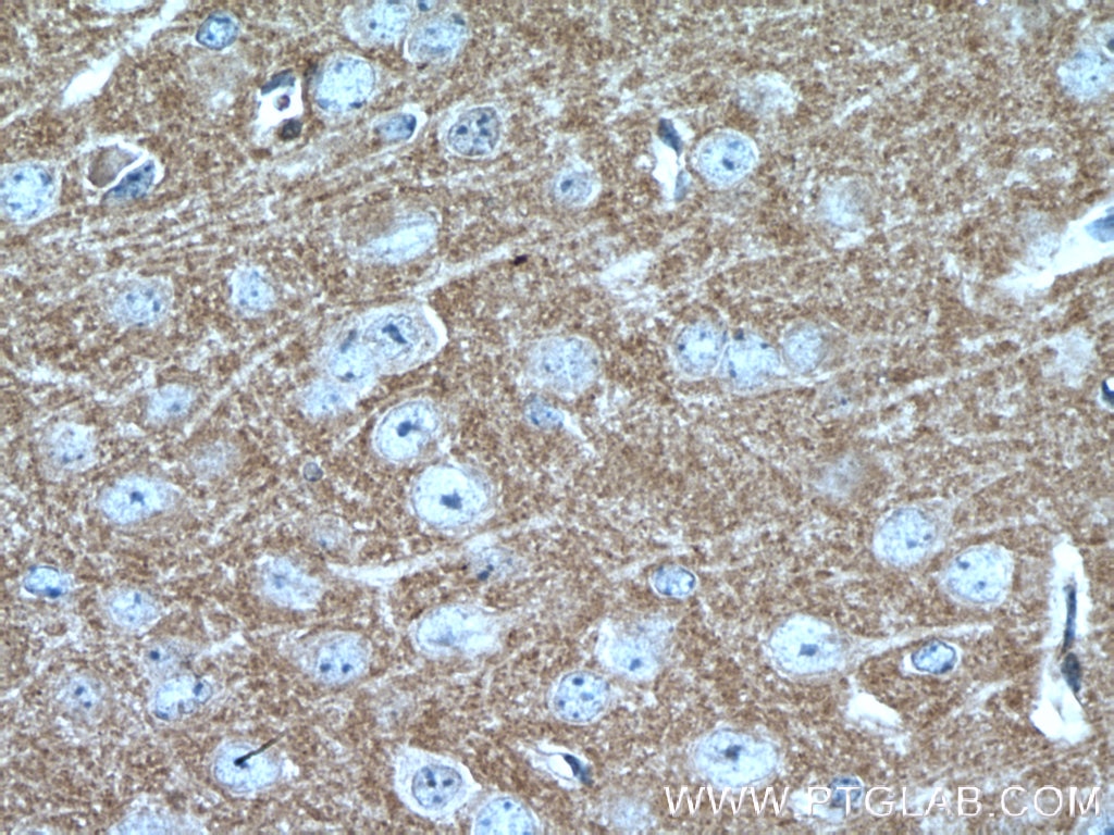 IHC staining of mouse brain using 17710-1-AP