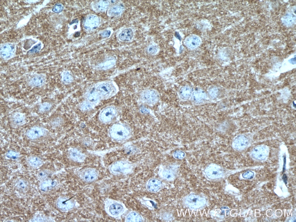 Immunohistochemistry (IHC) staining of mouse brain tissue using MPP5 Polyclonal antibody (17710-1-AP)