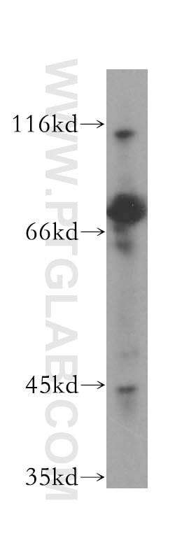 Western Blot (WB) analysis of human brain tissue using MPP5 Polyclonal antibody (17710-1-AP)