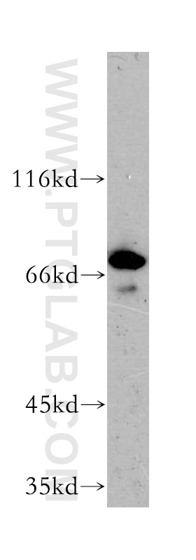MPP5 Polyclonal antibody