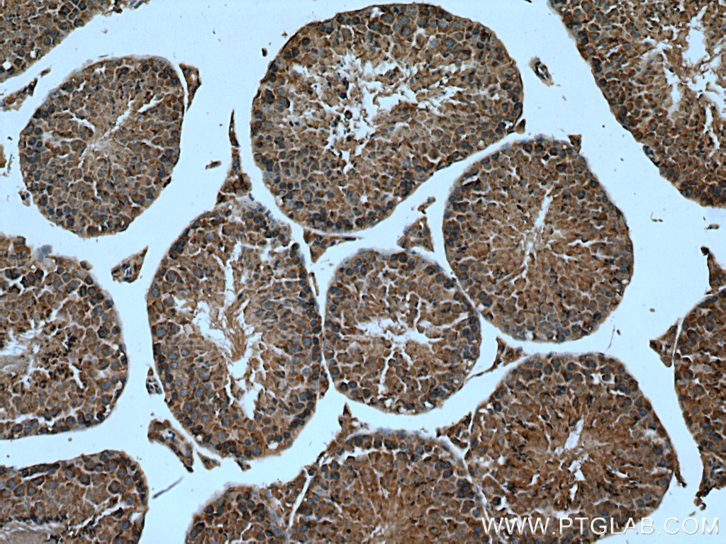 Immunohistochemistry (IHC) staining of mouse testis tissue using MPP6 Polyclonal antibody (11575-1-AP)