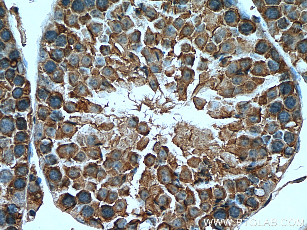 Immunohistochemistry (IHC) staining of mouse testis tissue using MPP6 Polyclonal antibody (11575-1-AP)