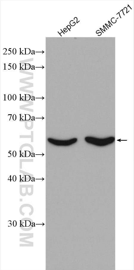 Western Blot (WB) analysis of various lysates using MPP6 Polyclonal antibody (11575-1-AP)