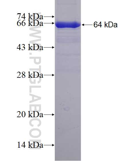 MPP6 fusion protein Ag2158 SDS-PAGE