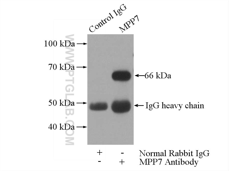 Immunoprecipitation (IP) experiment of HeLa cells using MPP7 Polyclonal antibody (12983-1-AP)
