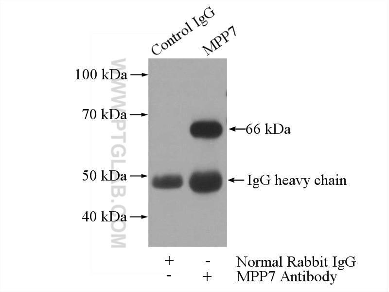 IP experiment of HeLa using 12983-1-AP