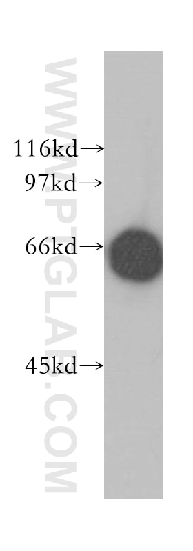 Western Blot (WB) analysis of HeLa cells using MPP7 Polyclonal antibody (12983-1-AP)