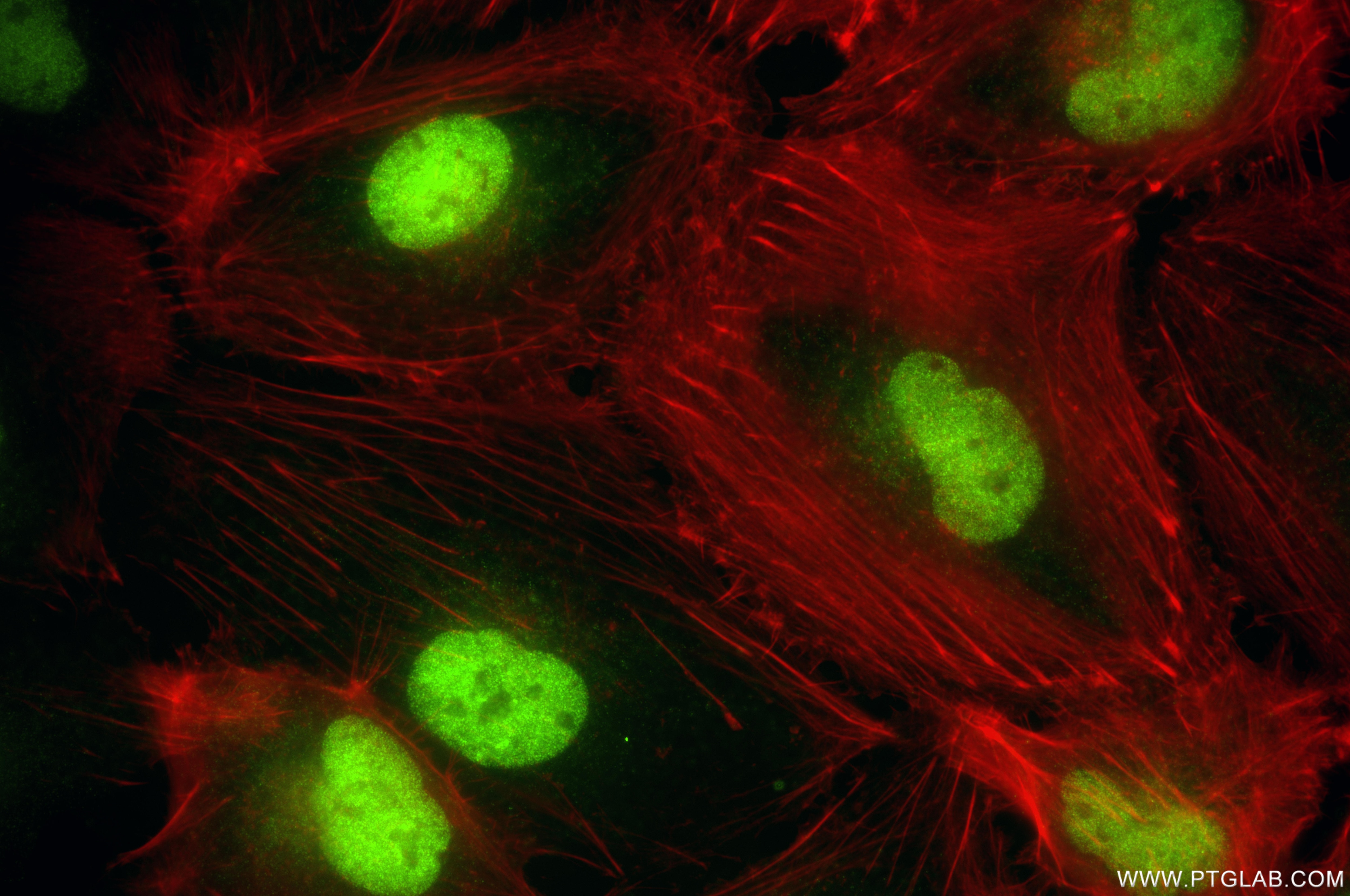 Immunofluorescence (IF) / fluorescent staining of U-251 cells using MPP8 Recombinant monoclonal antibody (84719-4-RR)