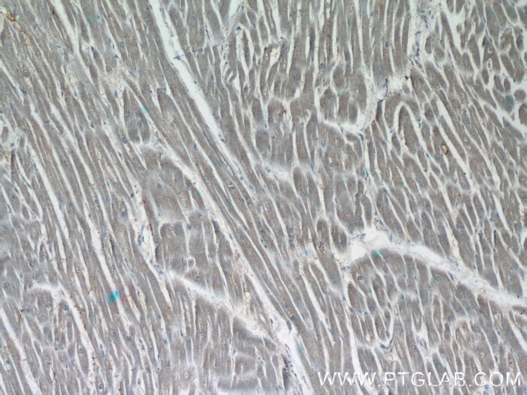 Immunohistochemistry (IHC) staining of human heart tissue using MPPED1 Polyclonal antibody (13677-1-AP)