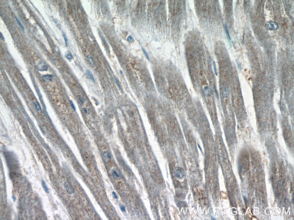 Immunohistochemistry (IHC) staining of human heart tissue using MPPED1 Polyclonal antibody (13677-1-AP)