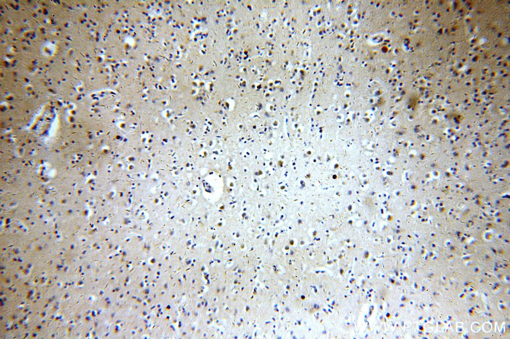 IHC staining of human brain using 13677-1-AP