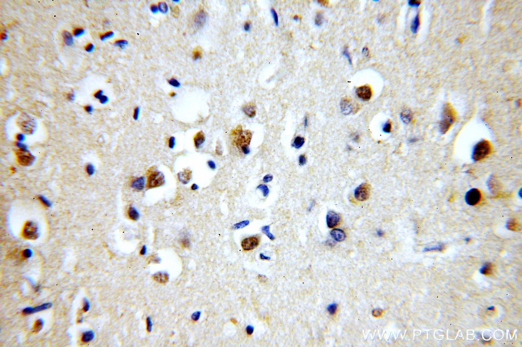 Immunohistochemistry (IHC) staining of human brain tissue using MPPED1 Polyclonal antibody (13677-1-AP)