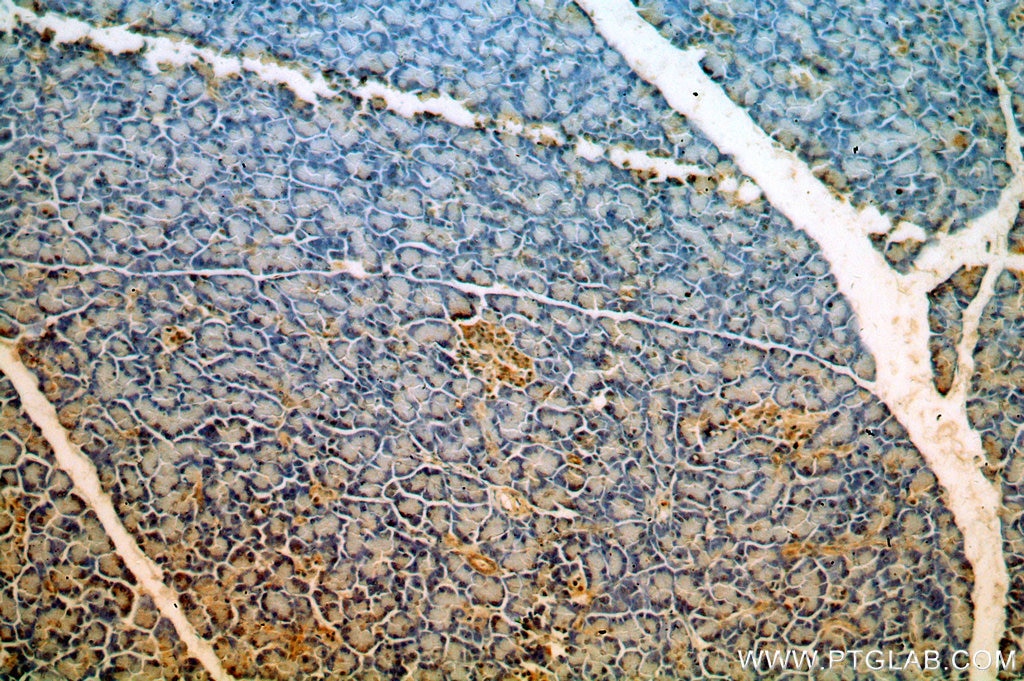 Immunohistochemistry (IHC) staining of human pancreas tissue using MPPED1 Polyclonal antibody (13677-1-AP)