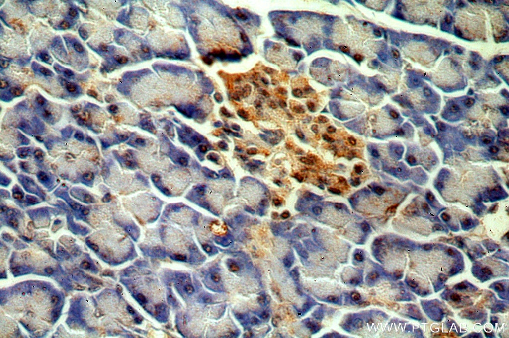 Immunohistochemistry (IHC) staining of human pancreas tissue using MPPED1 Polyclonal antibody (13677-1-AP)