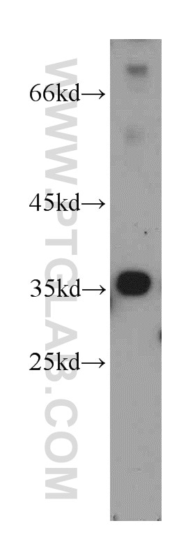 Western Blot (WB) analysis of mouse brain tissue using MPPED1 Polyclonal antibody (13677-1-AP)