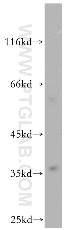 Western Blot (WB) analysis of rat brain tissue using MPPED1 Polyclonal antibody (13677-1-AP)