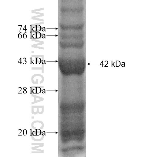 MPPED1 fusion protein Ag14470 SDS-PAGE