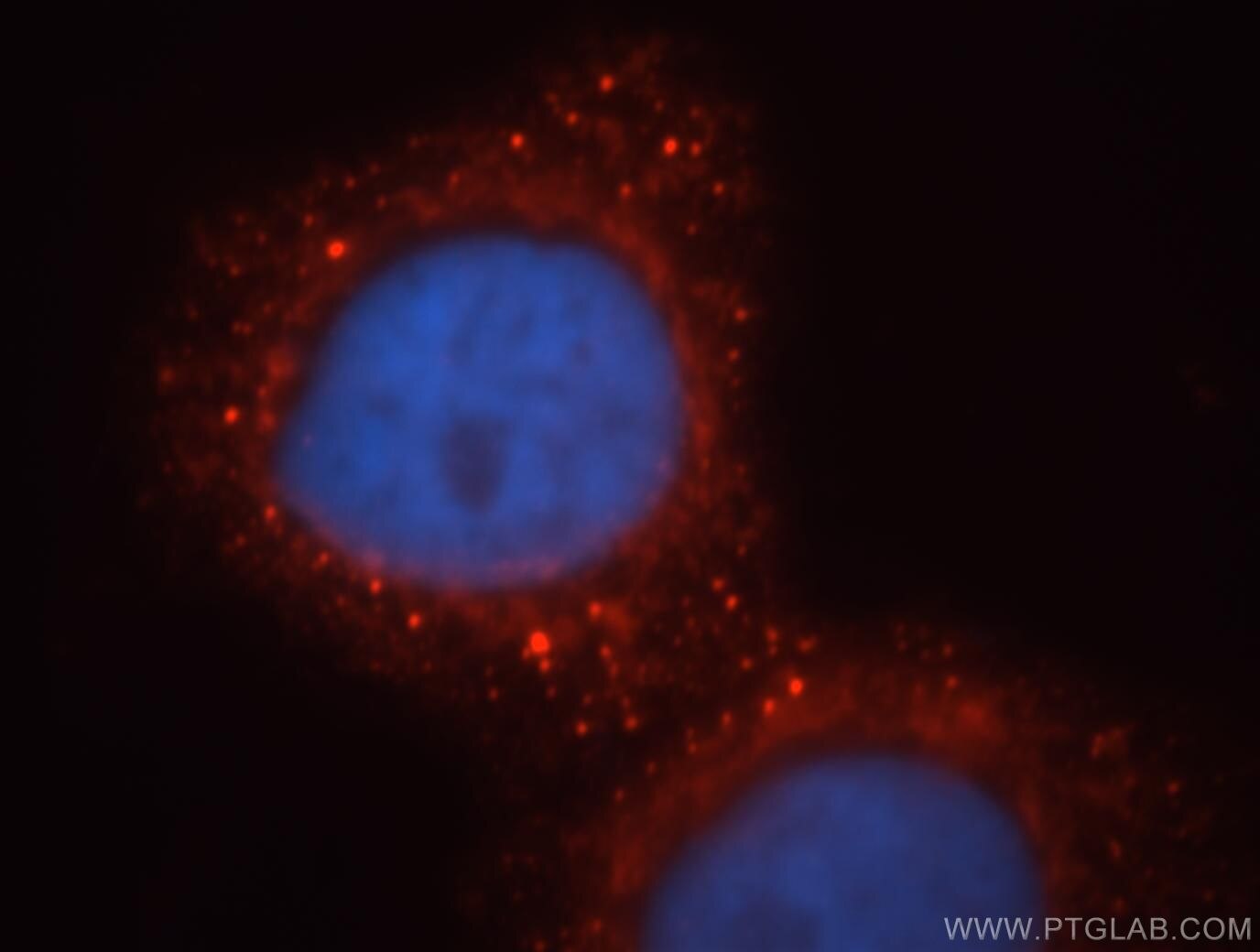 Immunofluorescence (IF) / fluorescent staining of HeLa cells using MPPED2 Polyclonal antibody (13270-1-AP)