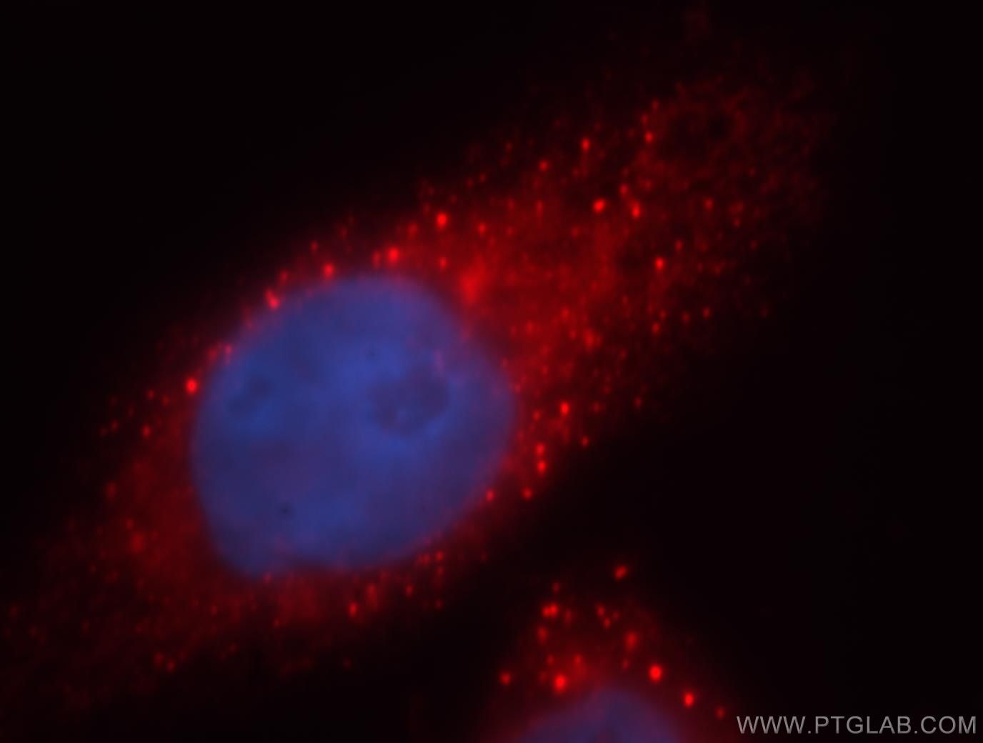 Immunofluorescence (IF) / fluorescent staining of HeLa cells using MPPED2 Polyclonal antibody (13270-1-AP)