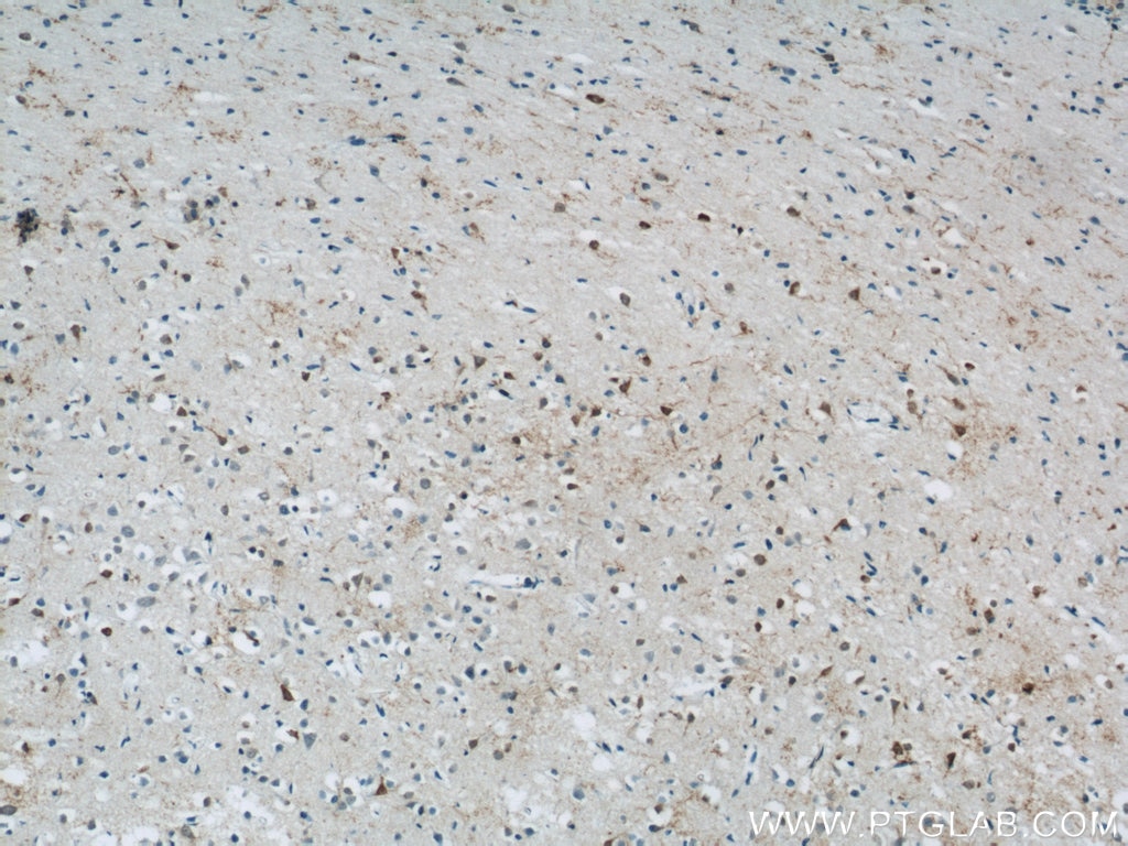 Immunohistochemistry (IHC) staining of human brain tissue using MPPED2 Polyclonal antibody (13270-1-AP)