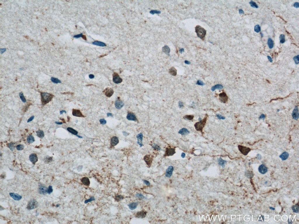 Immunohistochemistry (IHC) staining of human brain tissue using MPPED2 Polyclonal antibody (13270-1-AP)
