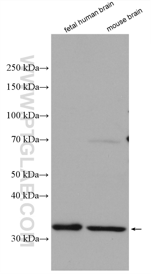 Western Blot (WB) analysis of various lysates using MPPED2 Polyclonal antibody (13270-1-AP)