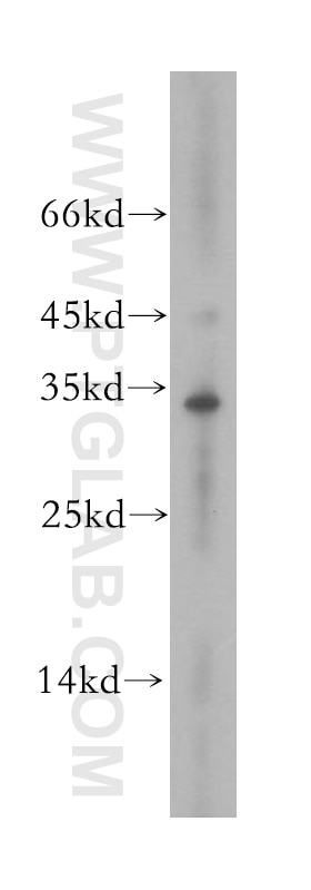 Western Blot (WB) analysis of human brain tissue using MPPED2 Polyclonal antibody (13270-1-AP)