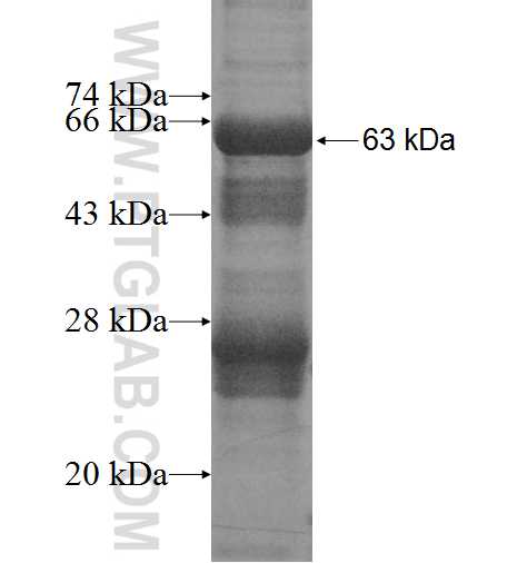 MPPED2 fusion protein Ag3963 SDS-PAGE
