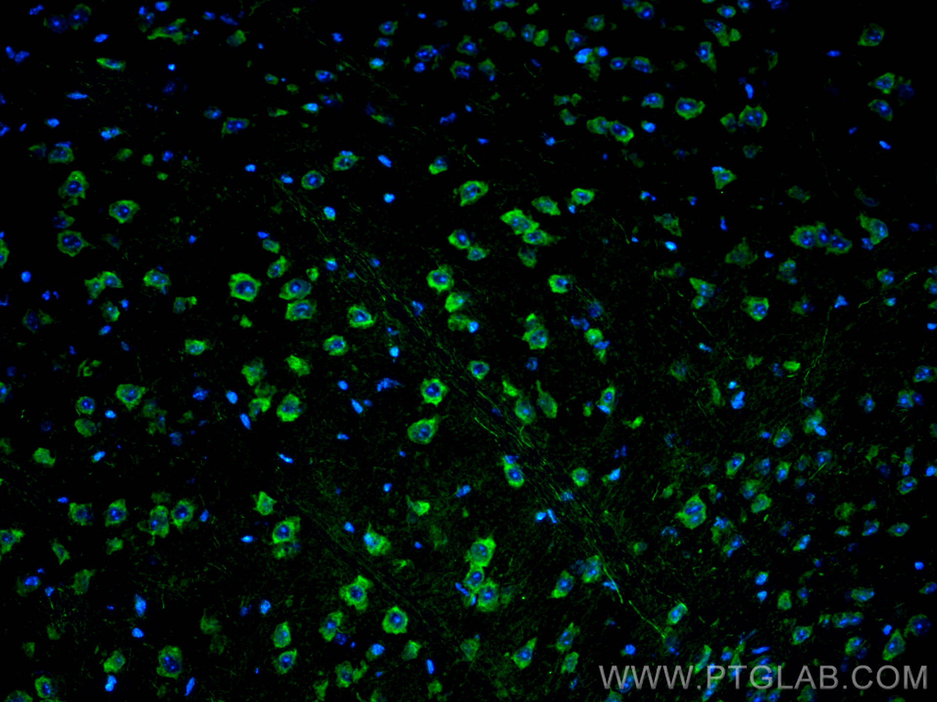 Immunofluorescence (IF) / fluorescent staining of mouse brain tissue using MPRIP Polyclonal antibody (20040-1-AP)
