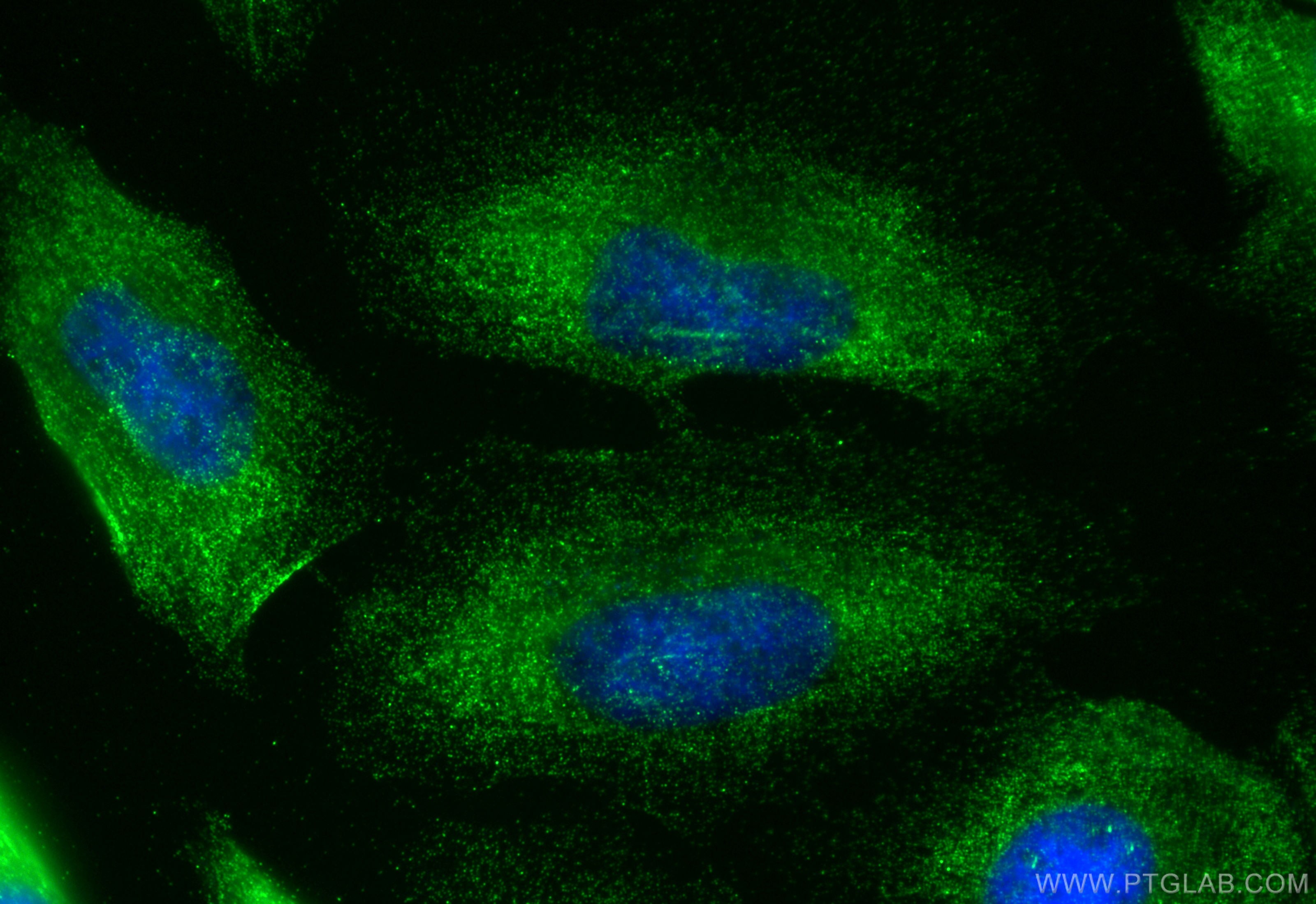 Immunofluorescence (IF) / fluorescent staining of HeLa cells using MPRIP Polyclonal antibody (20040-1-AP)