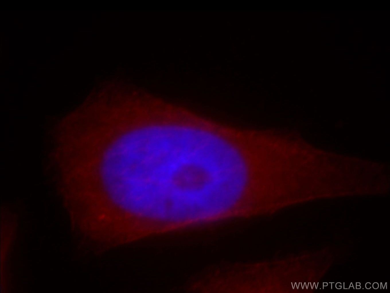 Immunofluorescence (IF) / fluorescent staining of HeLa cells using MPRIP Polyclonal antibody (20040-1-AP)