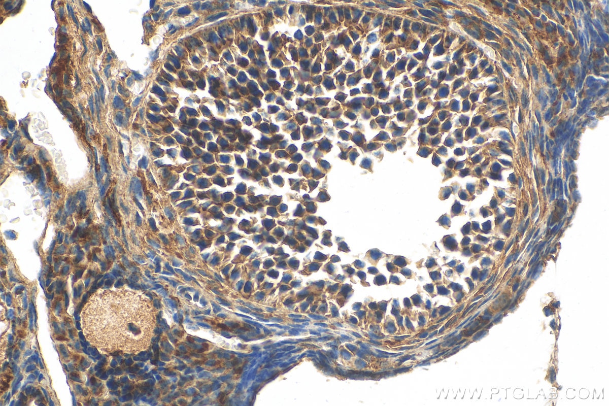 Immunohistochemistry (IHC) staining of mouse ovary tissue using MPRIP Polyclonal antibody (20040-1-AP)